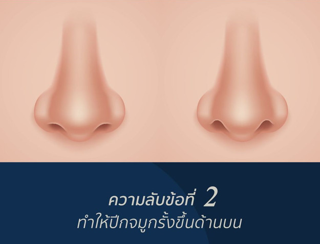 ปีกจมูกรั้งขึ้นด้านบน