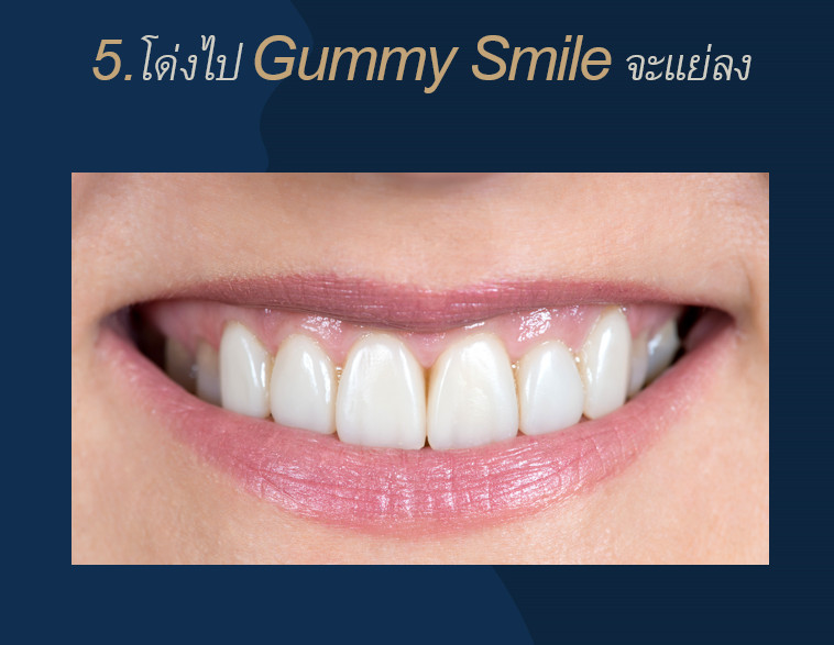 คนที่มีgummysmile