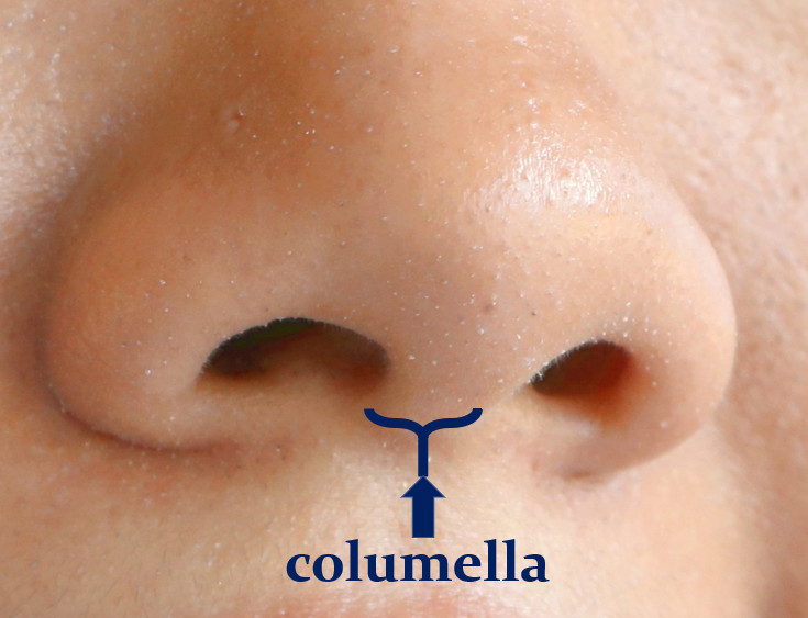 ฐาน columella กว้าง