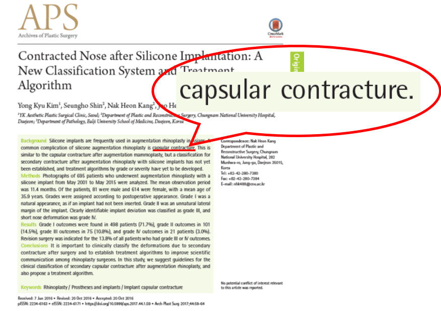 Capsular Contracture