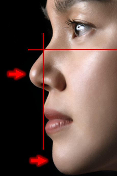 สันจมูกไม่ควรโด่งมากไปจนเสมอกับหน้าผาก