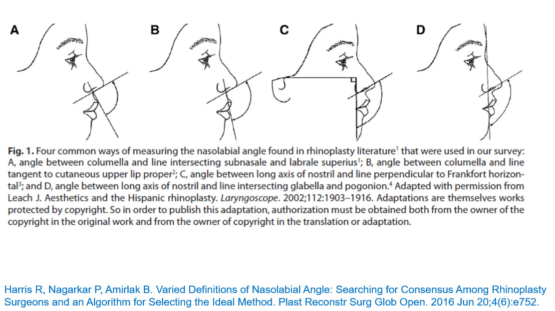 การวัด Nasolabial angle ต้องวัดอย่างไร