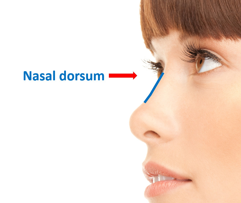 nasal dorsum