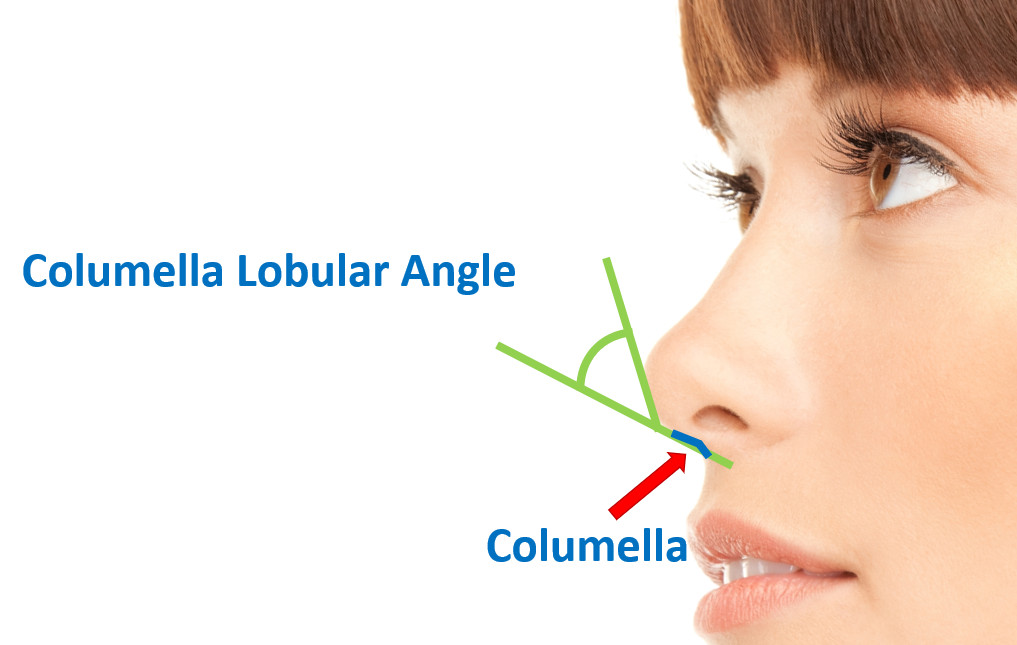 มุมระหว่าง infratip lobule กับ columella