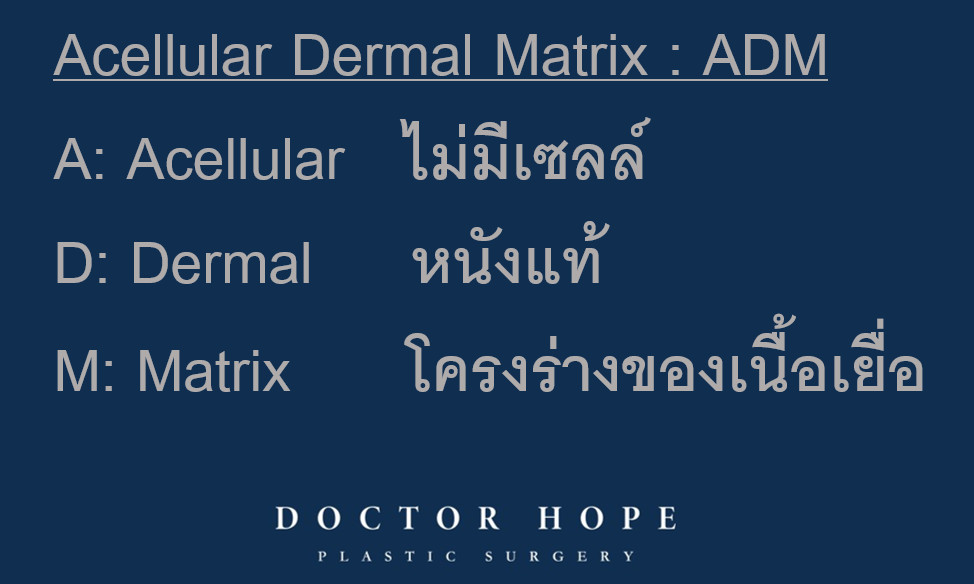 acellular dermal matrix